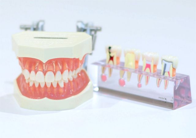 入れ歯を入れることで予防できる症状